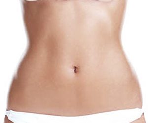 Abdominoplastia | Plástica do Abdome | Dr. Gustavo R Moreno, Brasília, DF