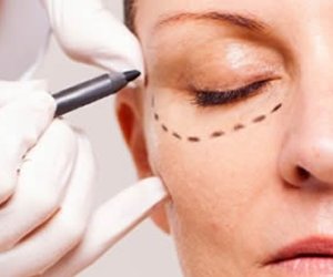 Dr. Gustavo R Moreno | Blefaroplastia Rio de Janeiro e Brasília | Plástica das pálpebras Dr. Gustavo R Moreno | Blefaroplastia Rio de Janeiro e Brasília | Plástica das pálpebras