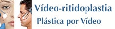 Plástica Facial por vídeo Rio de Janeiro e Brasília, ritidoplastia endoscópica