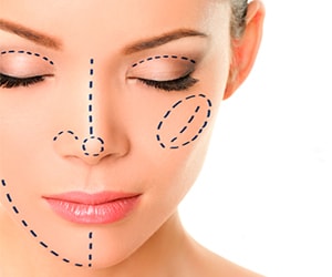 Lipofilling lipoescultura facial Rio de Janeiro e Brasilia