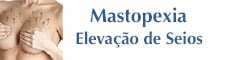 Mastopexia lifting mama Rio de Janeiro Brasília