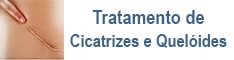 tratamento de cicatrizes e queloides Rio de Janeiro e Brasilia
