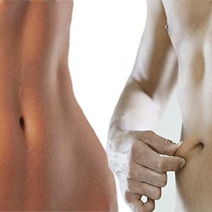 Lipoaspiração Rio de Janeiro e Brasília: Lipo LASER, Lipo HD, Vibro-lipo