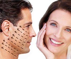Lifting Facial Rio de Janeiro